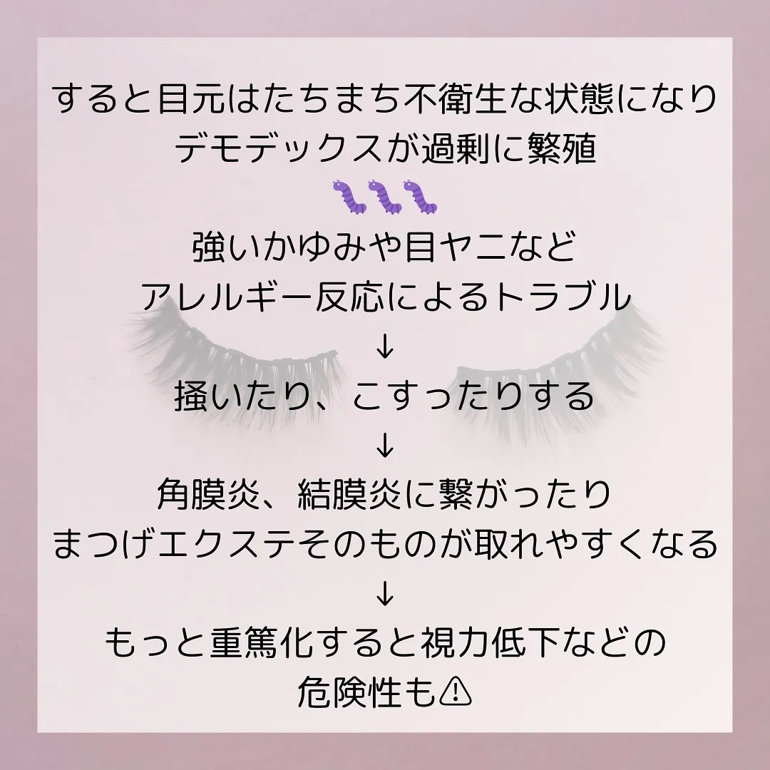 🫎あなたは大丈夫？恐怖のまつげダニ🫎